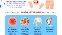 <a href="/tin-do-hoa" title="Infographic" rel="dofollow">TIN ĐỒ HOẠ</a>